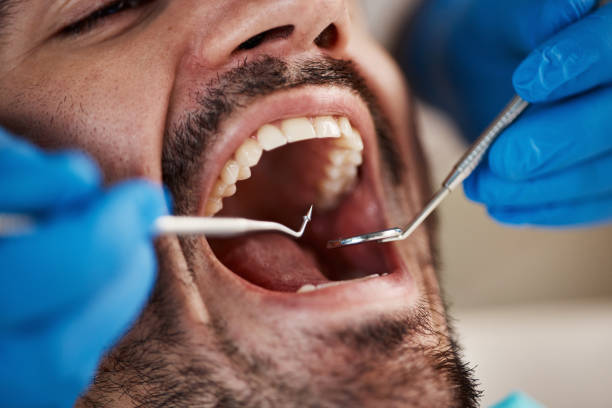 Best Urgent Care for Lost Fillings or Crowns in Orange Cove, CA