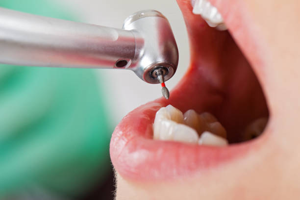 Best Weekend Emergency Dentist in Orange Cove, CA